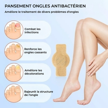 FungalPatch - Patch Antibactérien Antifongique et Soin des Ongles Pack