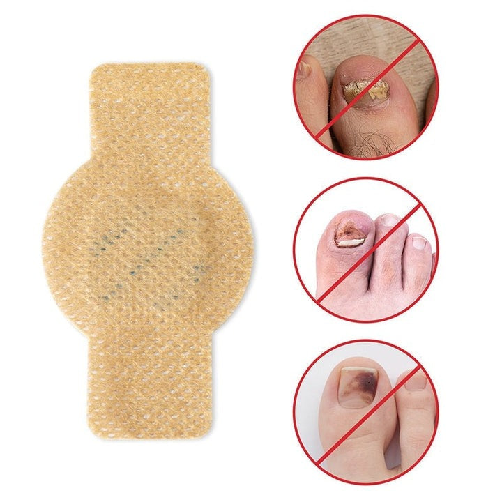 FungalPatch - Patch Antibactérien Antifongique et Soin des Ongles Pack