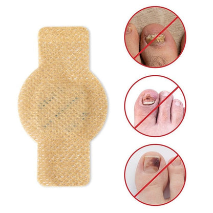 FungalPatch - Patch Antibactérien Antifongique et Soin des Ongles Pack