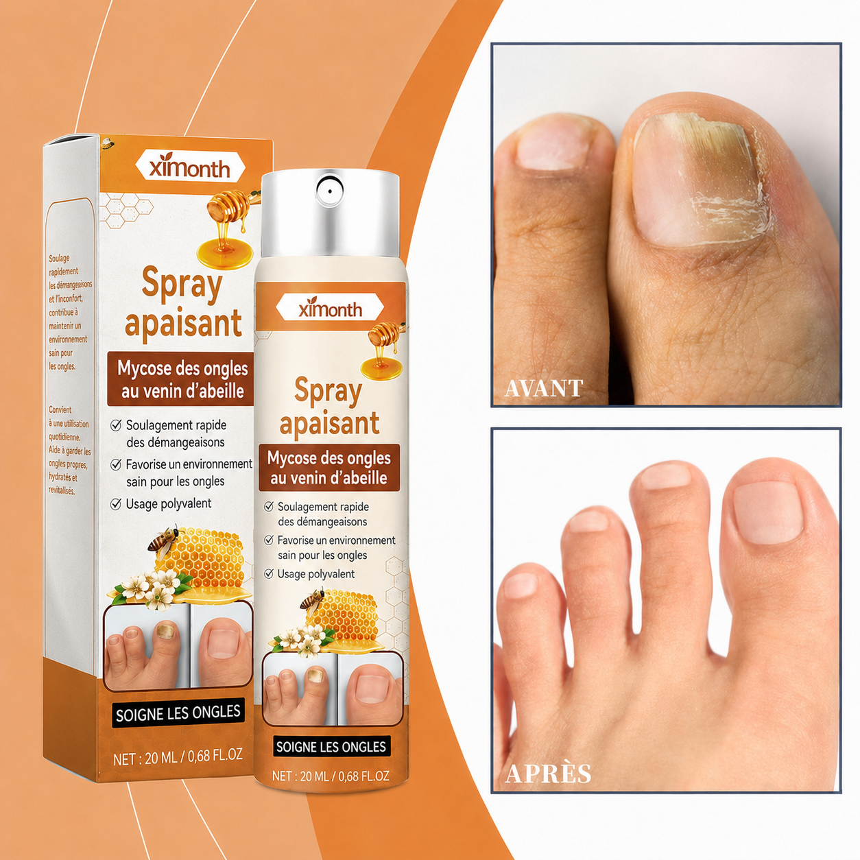 Spray au venin d’abeille contre les mycoses des ongles