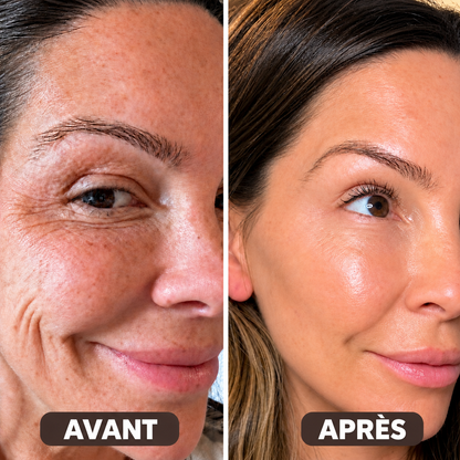 Collagen Volume Balm – Pour les rides et la peau relâchée
